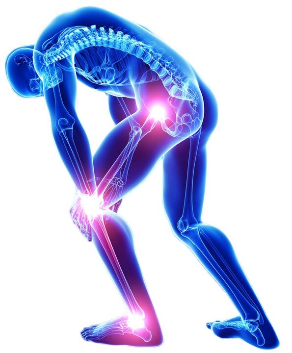 El dolor agudo al moverse es un síntoma de enfermedad articular. 