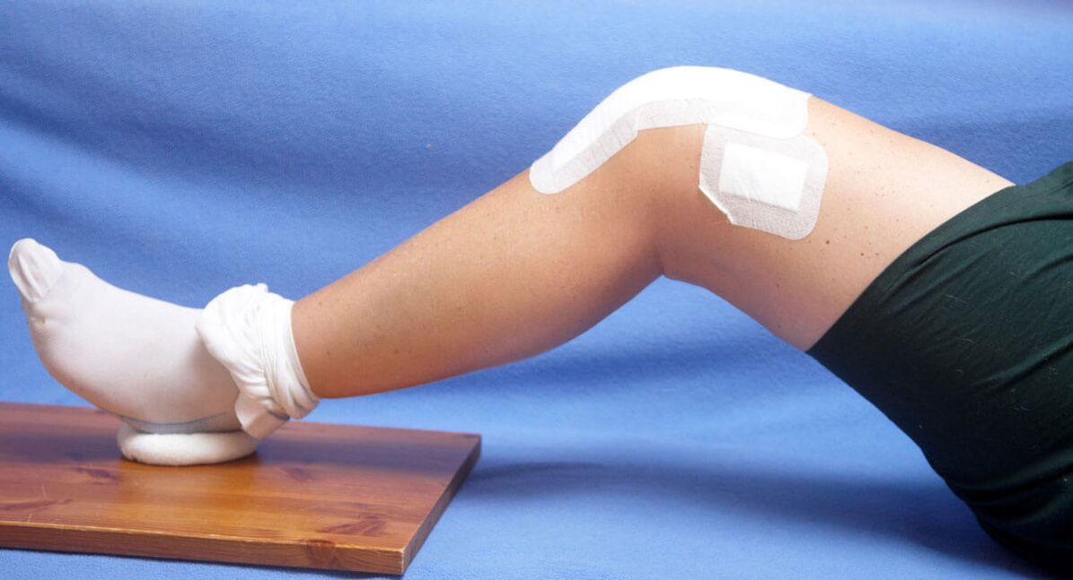 Lesión de rodilla como causa de artrosis. 