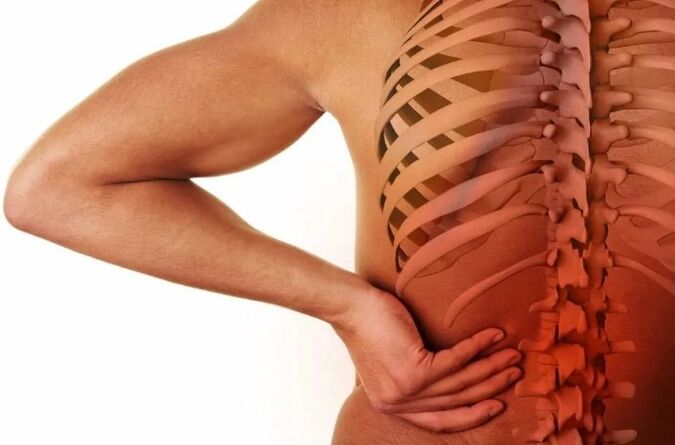 Osteocondrosis lumbar