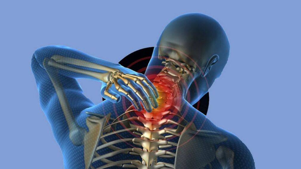 Osteocondrosis de la región cervical