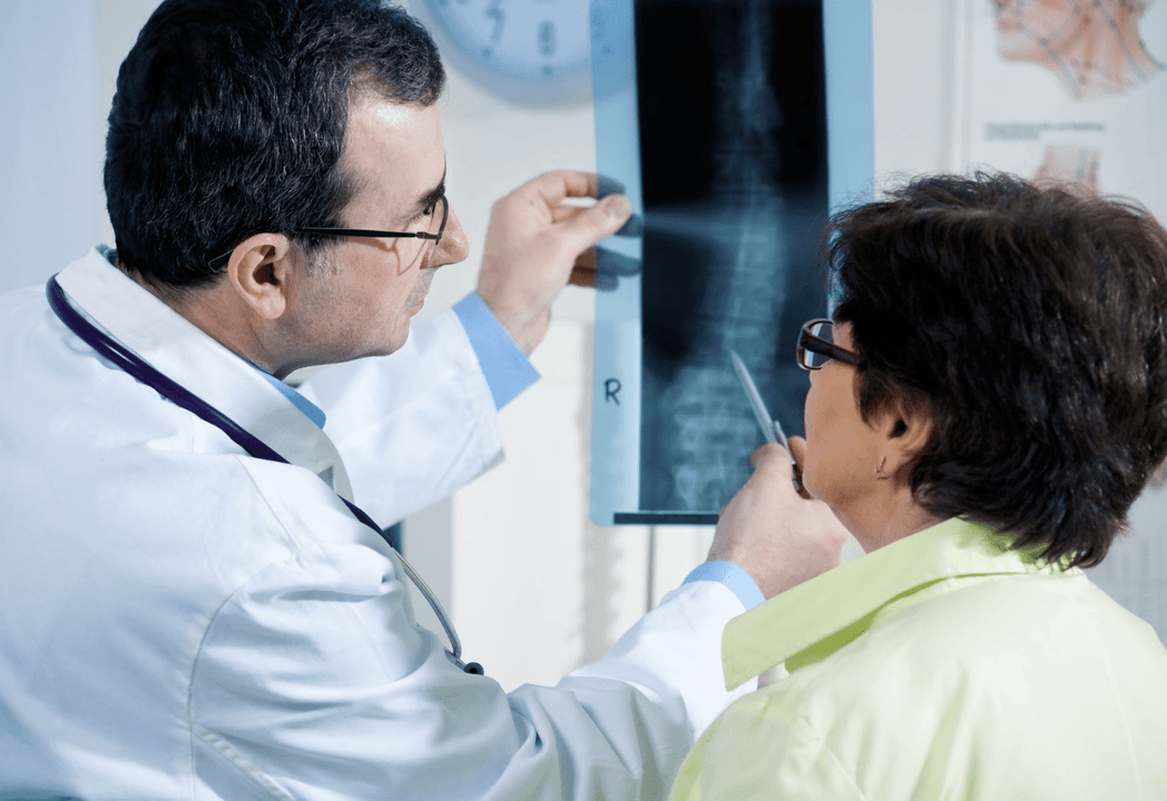 Un neurólogo diagnostica osteocondrosis mediante radiografías de la columna