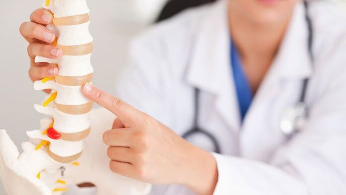 Explicación de la osteocondrosis lumbar en un modelo de columna.